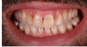 Before image