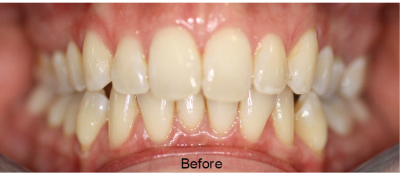 Before image