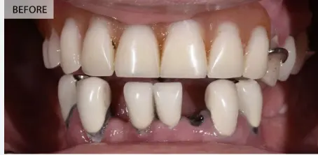Before image