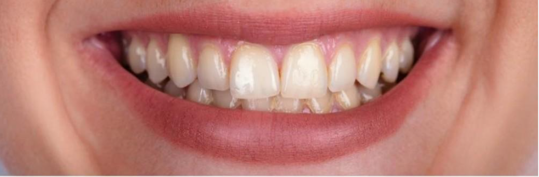 Before image