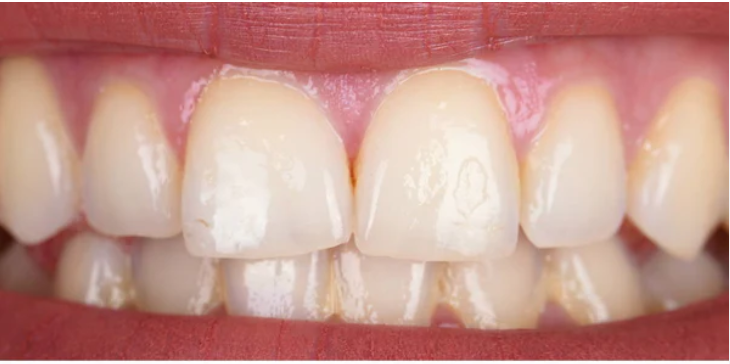 Before image