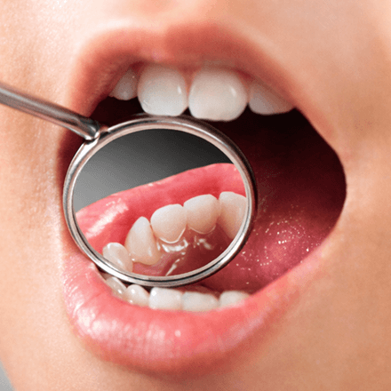Major Procedures Icon