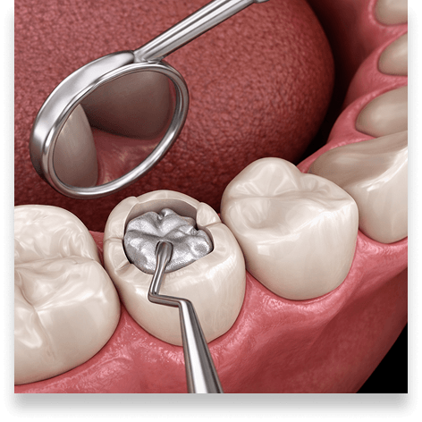 Basic Fillings Icon